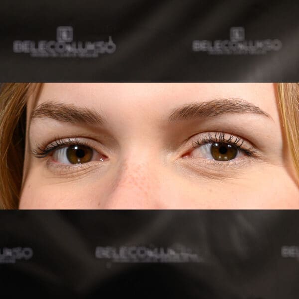 Micrograyling PRESTIGE Focus brows