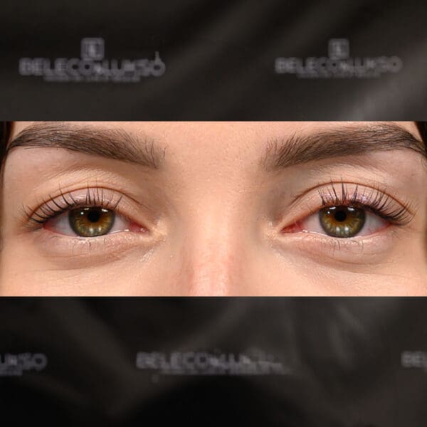 Eyelashes Enhancement PRESTIGE focus lashes