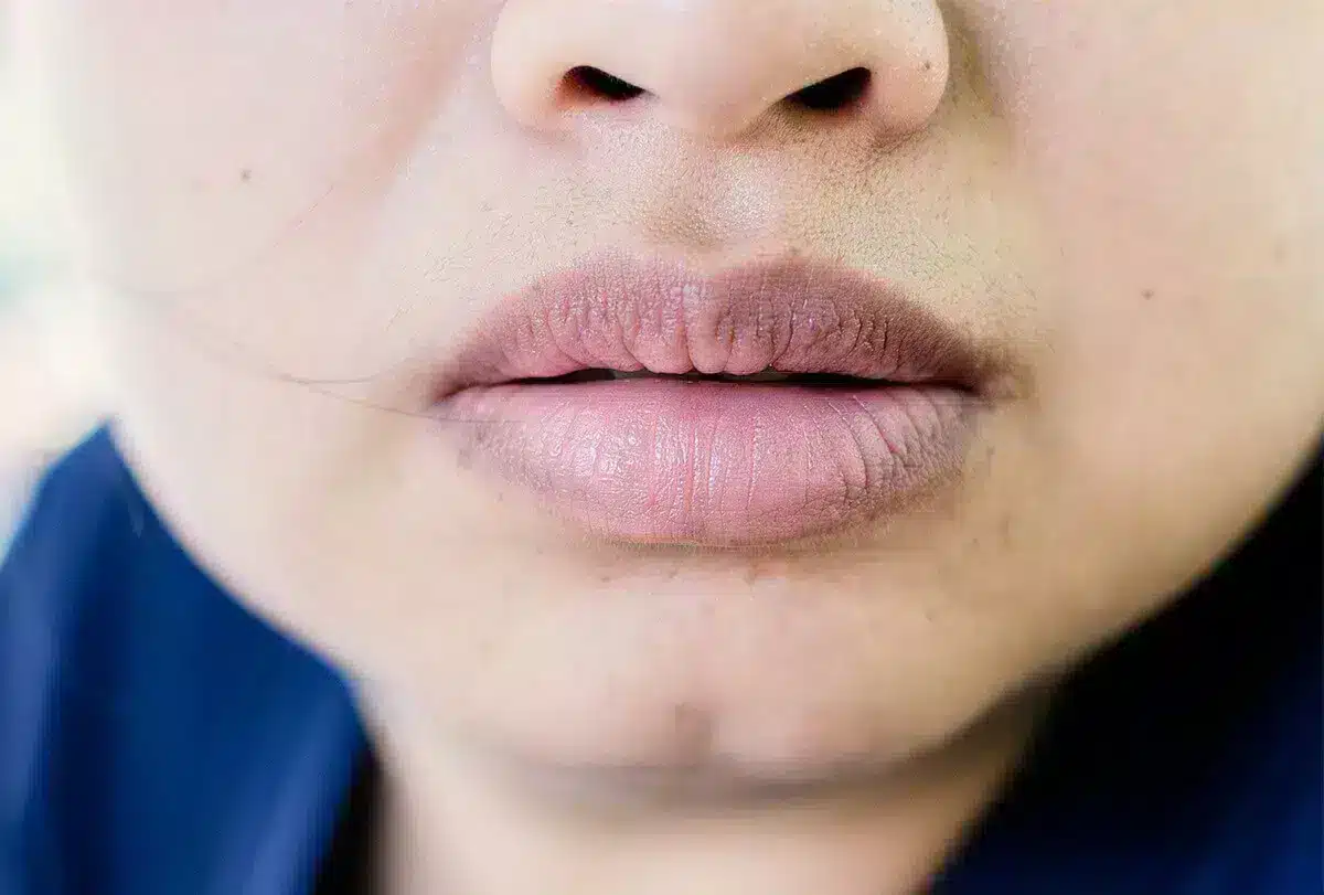 Dark Lips – Tout ce que vous devez savoir sur cette technique de neutralisation et d'embellissement des lèvres 2 levre bleues
