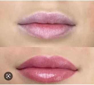 candy lips