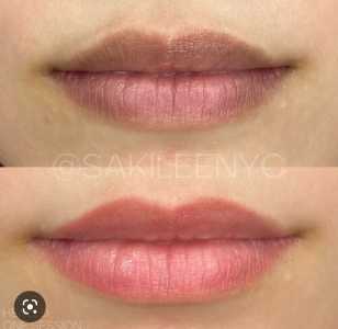 dark lips
